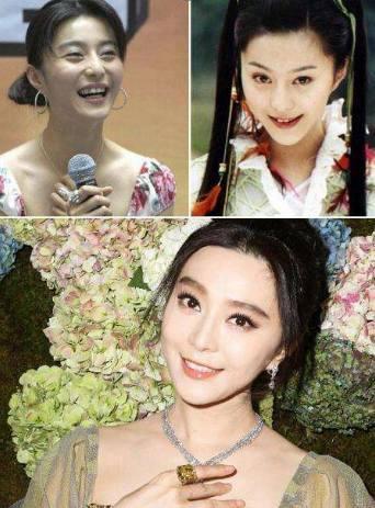 明星整牙范冰冰,从整牙到完美蜕变